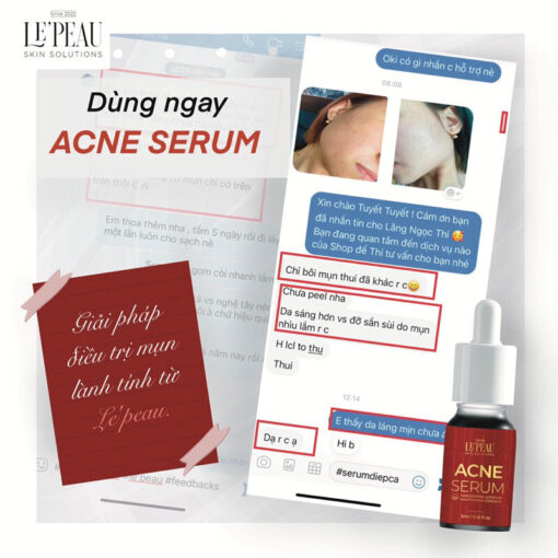 Serum mụn diếp cá LE'PEAU, hỗ trợ cải thiện mụn