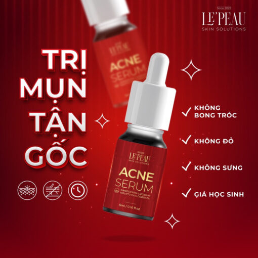 Serum mụn diếp cá LE'PEAU, hỗ trợ cải thiện mụn