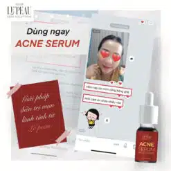 Serum mụn diếp cá LE'PEAU, hỗ trợ cải thiện mụn