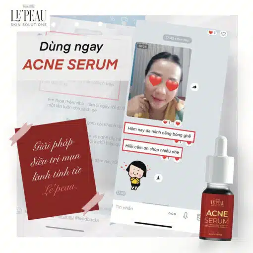 Serum mụn diếp cá LE'PEAU, hỗ trợ cải thiện mụn