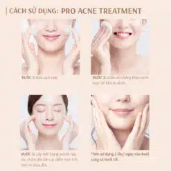 Tinh Chất Giảm Mụn Thâm Monux Pro Acne Treatment 15g