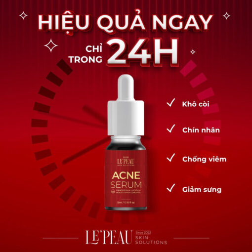 Serum mụn diếp cá LE'PEAU, hỗ trợ cải thiện mụn