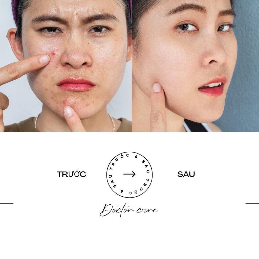 Bộ giảm Mụn ẩn Mụn đầu đen Mụn thâm Doctor Care 20ml (serum+ kem) 6 images upload woo2Ffe472a7dbee352b2ee81613b2dd49fc6
