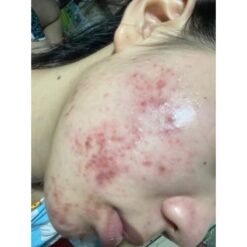 Combo giảm mụn, mờ thâm, dưỡng da sáng mịn IGREEN là sự kết hợp hoàn hảo giữa Serum Diếp Cá IGREEN và Sữa Rửa Mặt Diếp Cá IGREEN 13 images upload woo2F684ab5bf6634f87c1619e988fd5e27b7