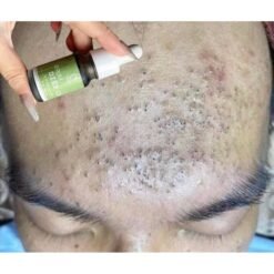 Combo giảm mụn, mờ thâm, dưỡng da sáng mịn IGREEN là sự kết hợp hoàn hảo giữa Serum Diếp Cá IGREEN và Sữa Rửa Mặt Diếp Cá IGREEN 16 images upload woo2Ffe4834c2d8d956b6870f2cbead0fe53e